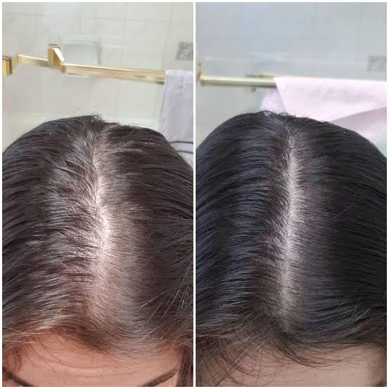 Before and after photo comparison