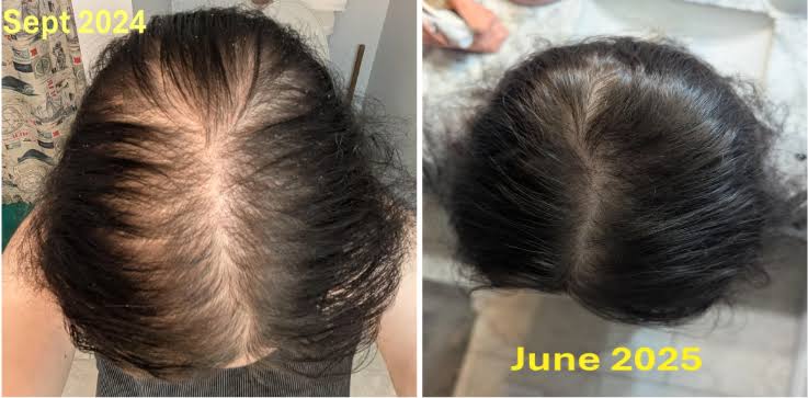 Before and after photo comparison